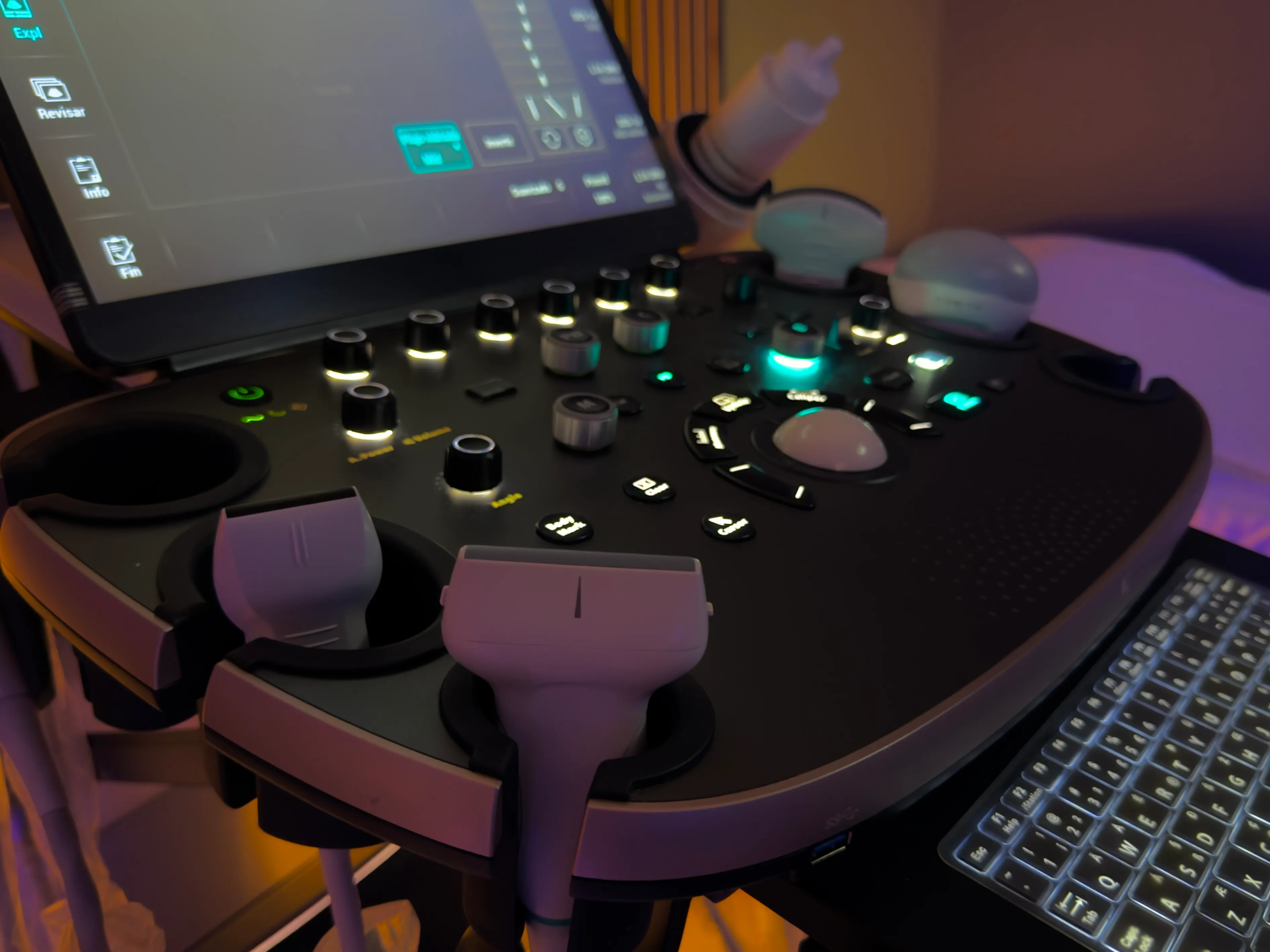 Equipo de ultrasonido