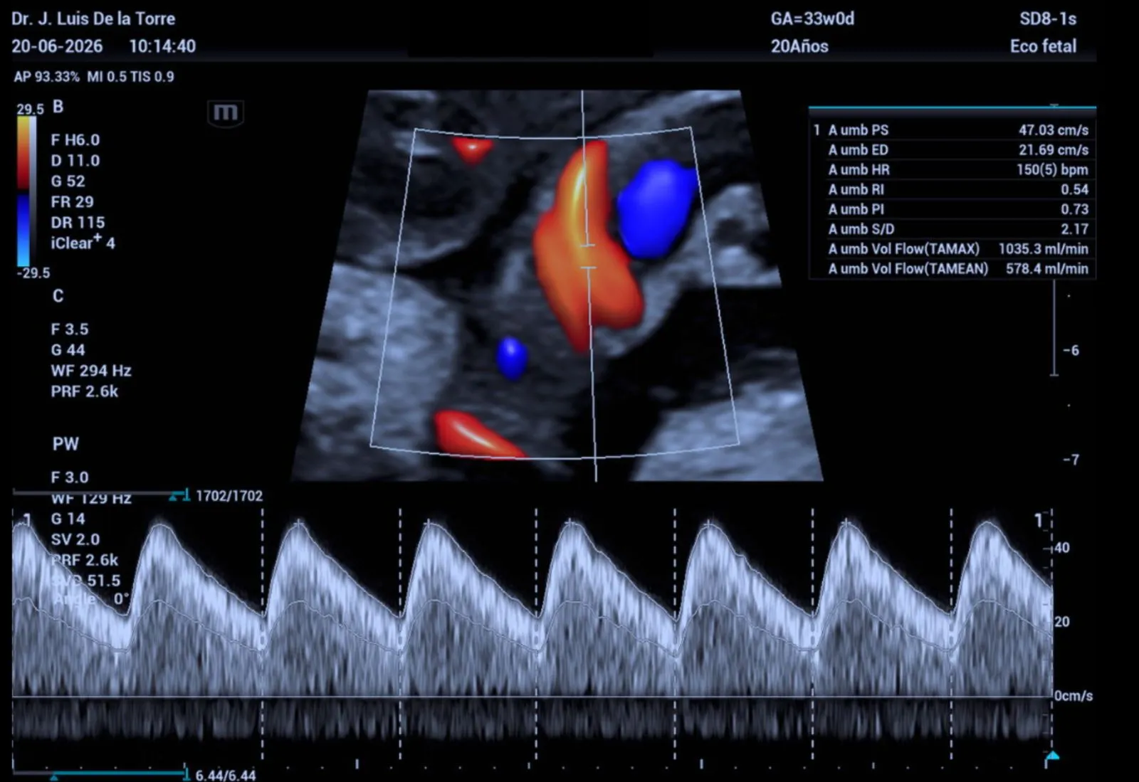 Ultrasonido Obstétrico de Crecimiento (32-36 semanas)